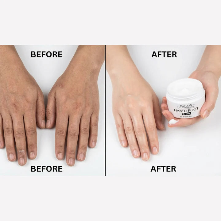 Havelyn Hand Foot & Night Cream Body Bundal Discount Deal,s Limited